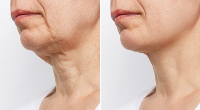 Kosztuje mniej niż 15 zł, a napina skórę na szyi i dekolcie jak naciągające nici. Mistrz ujędrnienia