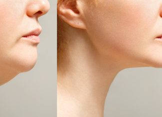 Unosi podbródek i modeluje owal twarzy. „Polecam ten produkt każdej kobiecie”