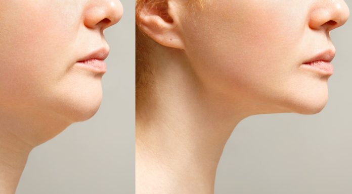 Unosi podbródek i modeluje owal twarzy. „Polecam ten produkt każdej kobiecie”