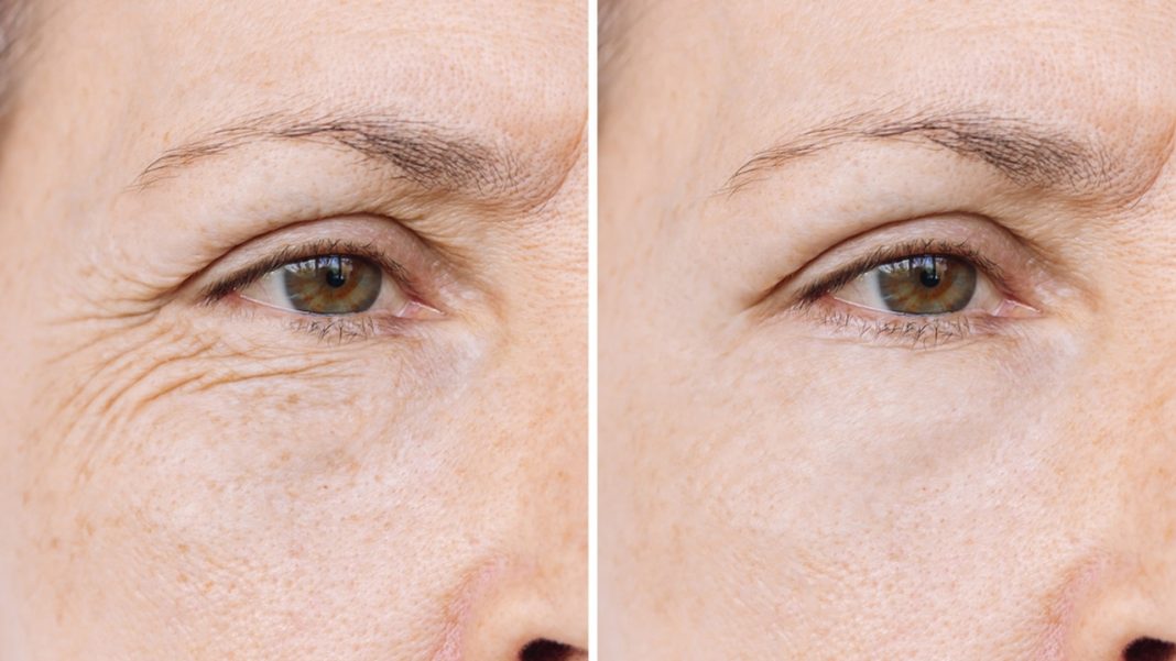 Trzy kremy z uderzeniową dawką kwasu hialuronowego. To pogromcy zmarszczek