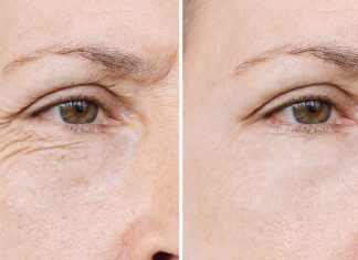 Trzy kremy z uderzeniową dawką kwasu hialuronowego. To pogromcy zmarszczek