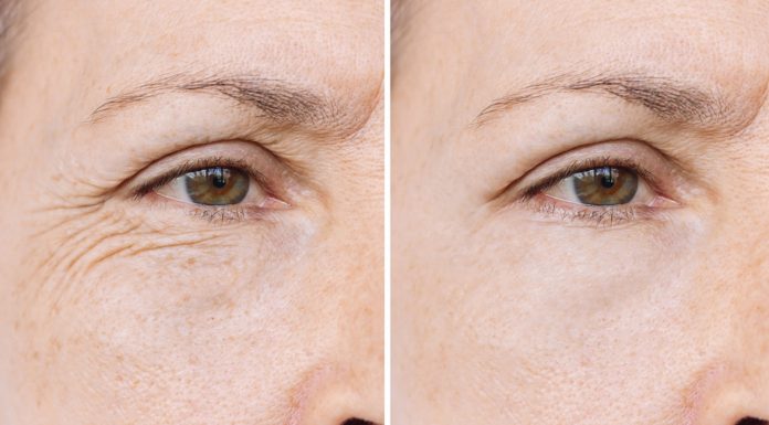 Trzy kremy z uderzeniową dawką kwasu hialuronowego. To pogromcy zmarszczek