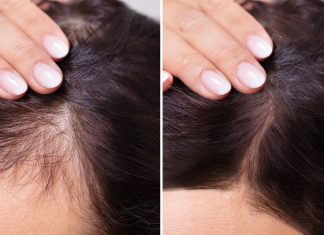 To serum kosmicznie zagęszcza włosy. Działa nawet na widoczne zakola, pokochały je 60-latki