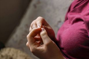 Wetrzyj w paznokcie. Żółte plamy znikną