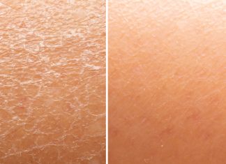 Trzy balsamy, które naprawdę nawilżają. Zapomnij o suchych skórkach i efekcie skóry węża