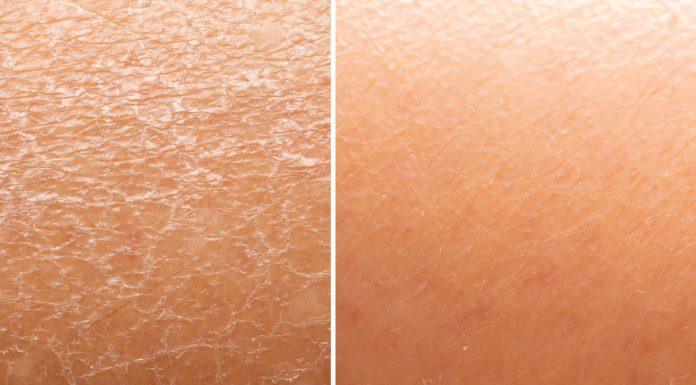 Trzy balsamy, które naprawdę nawilżają. Zapomnij o suchych skórkach i efekcie skóry węża