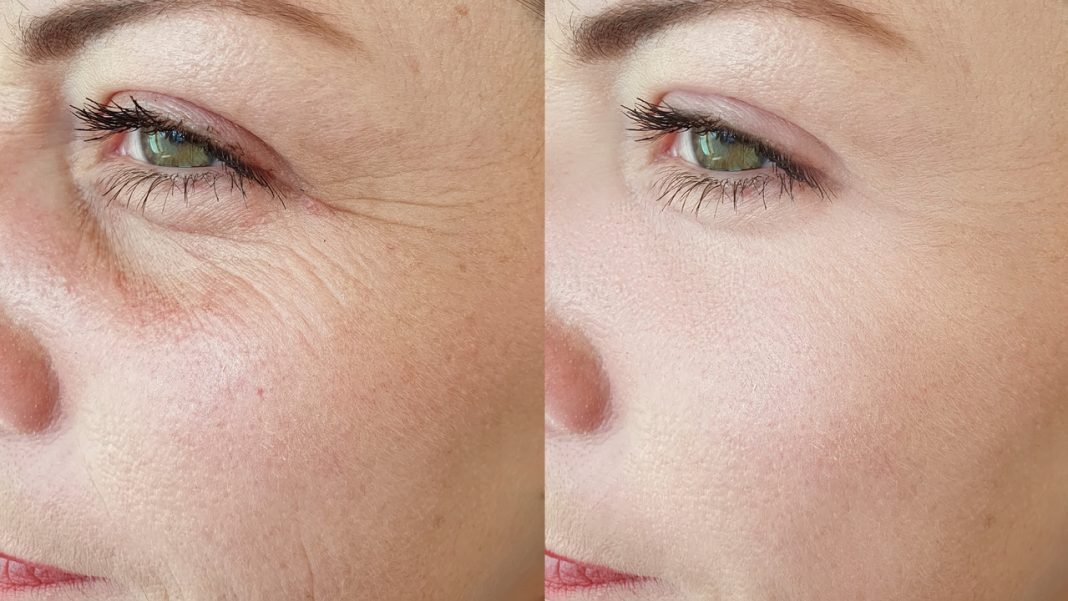 Stymuluje produkcję kolagenu. Ten krem to najlepsza kuracja anti-aging