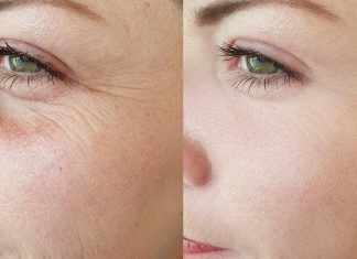 Stymuluje produkcję kolagenu. Ten krem to najlepsza kuracja anti-aging