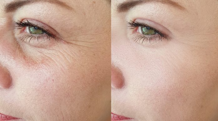 Stymuluje produkcję kolagenu. Ten krem to najlepsza kuracja anti-aging