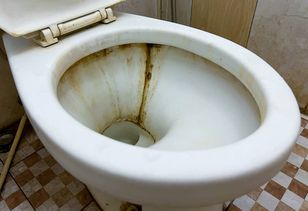 Nałóż na deskę sedesową. W mig uporasz się z brudem i kamieniem