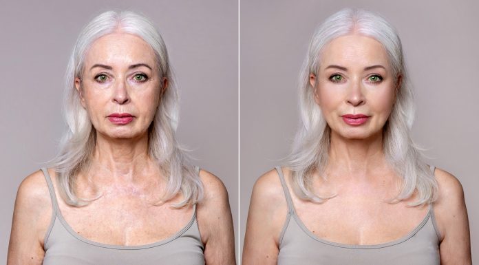 60-latki kupują po kilka opakowań tego kolagenowego kremu w dużej butelce. „Tani, a dobry!”