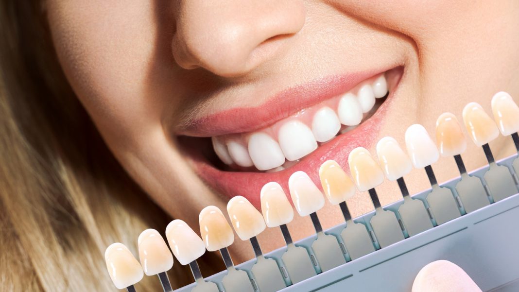 Mocno wybielające paski dla kawoszy i palaczy. Rozjaśniają zęby w pięć dni aktywnym tlenem molekularnym