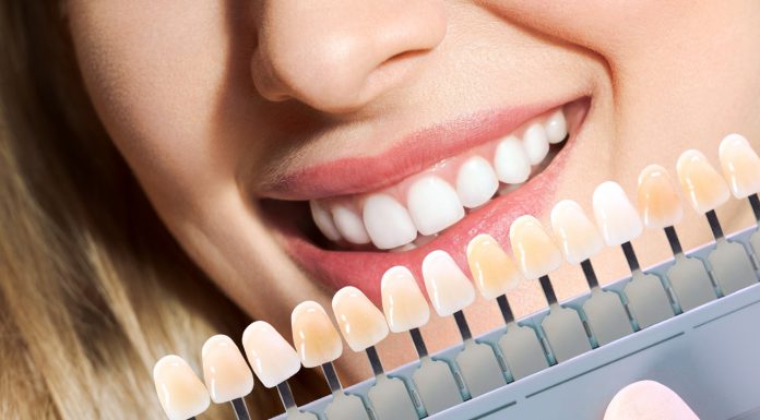 Mocno wybielające paski dla kawoszy i palaczy. Rozjaśniają zęby w pięć dni aktywnym tlenem molekularnym