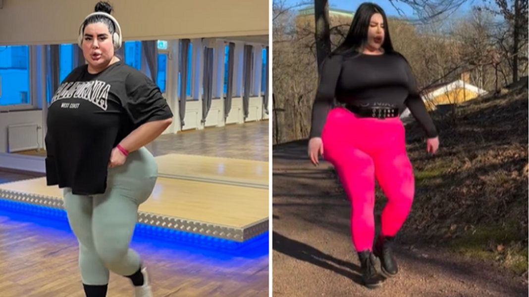 27-latka wydała pół miliona złotych na operacje plastyczne.