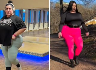 27-latka wydała pół miliona złotych na operacje plastyczne. „Większe jest lepsze”