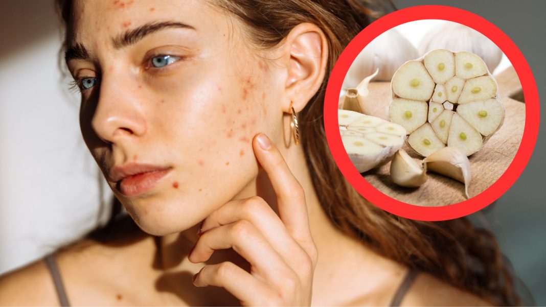 Nowy urodowy trend na TikToku. Dermatolożka ostrzega