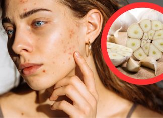 Nowy urodowy trend na TikToku. Dermatolożka ostrzega