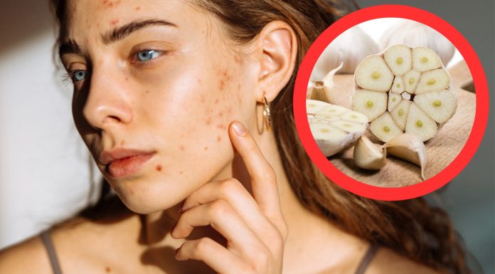 Nowy urodowy trend na TikToku. Dermatolożka ostrzega