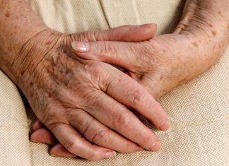 Skąd biorą się plamy wątrobowe? Nie mają nic wspólnego z tym narządem