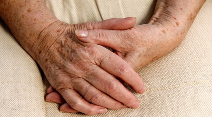 Skąd biorą się plamy wątrobowe? Nie mają nic wspólnego z tym narządem