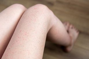 Wystarczy drobna zmiana. Problem