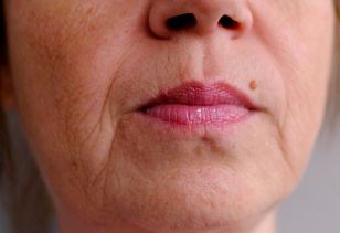 Króluje wśród kosmetyków. Rozjaśni szarą cerę i zwalczy zmarszczki