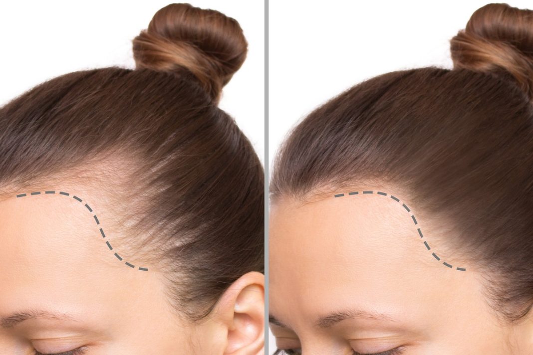 Trzy najlepsze produkty stymulujące odrost włosów. Działają nawet na mocne przerzedzenia