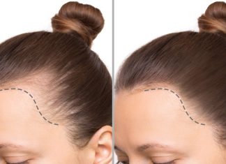 Trzy najlepsze produkty stymulujące odrost włosów. Działają nawet na mocne przerzedzenia