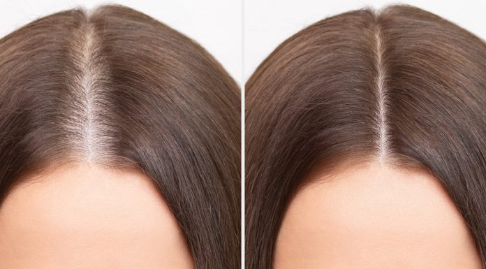 Ranking szamponów przeciw wypadaniu włosów. To częsty wybór trychologów i internautów