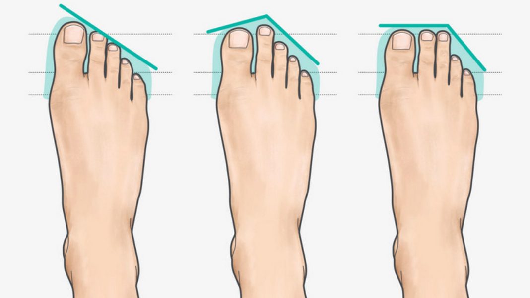 Stopa grecka. Taki układ palców może mieć wpływ na twoje zdrowie