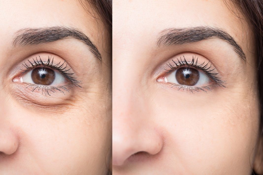 TOP 3 kremy na postarzające pierścienie pod oczami. Cudnie wygładzają i odejmują lat