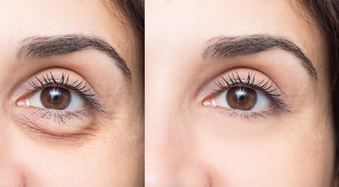 TOP 3 kremy na postarzające pierścienie pod oczami. Cudnie wygładzają i odejmują lat