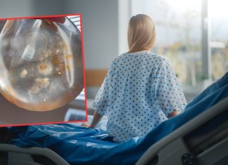 Usuwają implanty, wracają do naturalnych piersi. „To jest obrzydliwe”