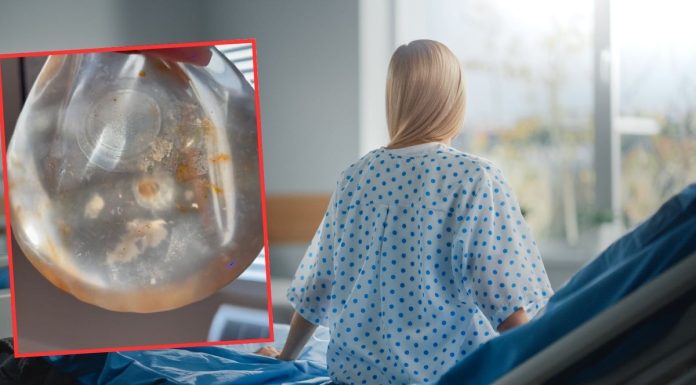 Usuwają implanty, wracają do naturalnych piersi. „To jest obrzydliwe”