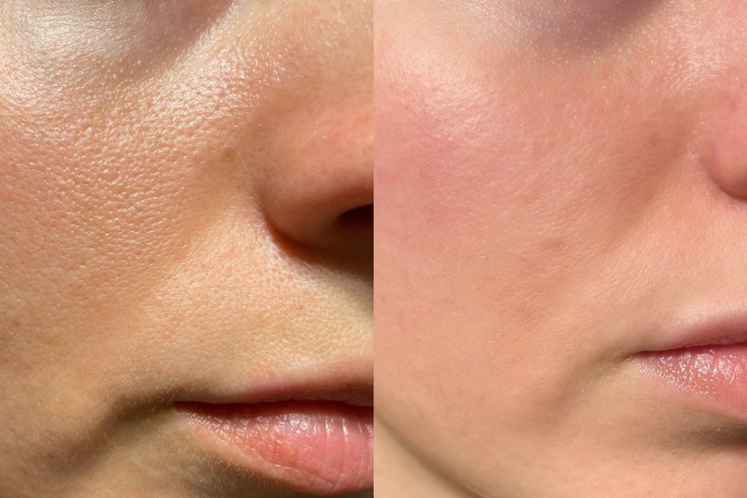 Trzy kremy BB do tłustej cery. Matują na cały dzień i nie tworzą efektu