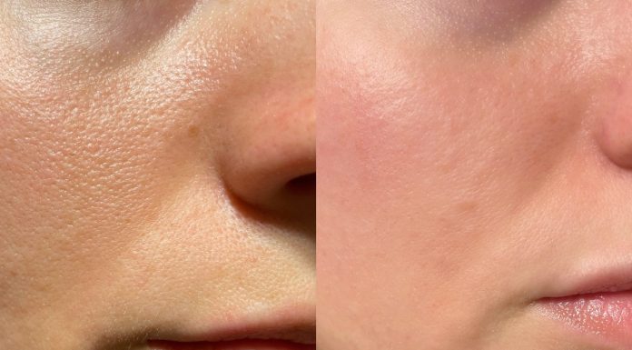 Trzy kremy BB do tłustej cery. Matują na cały dzień i nie tworzą efektu „maski”