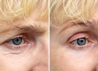 Pożegnaj spojrzenie babuni. Te trzy kremy pod oczy dla dojrzałych mistrzowsko wygładzają