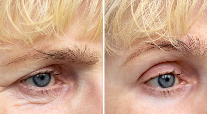 Pożegnaj spojrzenie babuni. Te trzy kremy pod oczy dla dojrzałych mistrzowsko wygładzają