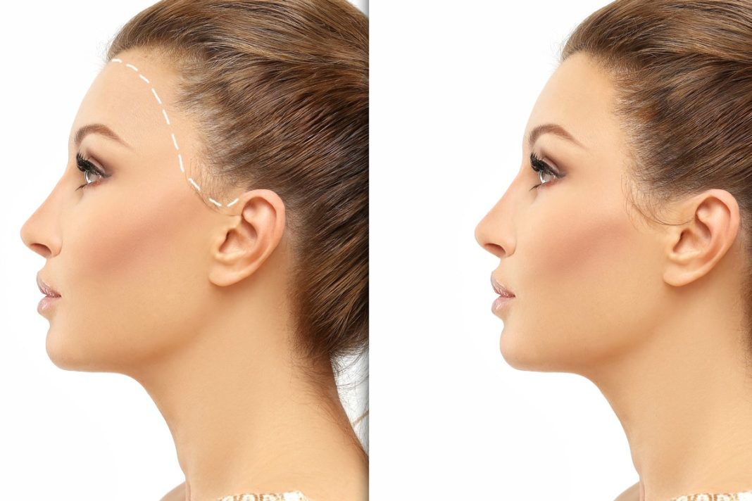 TOP 3 mocne kuracje w ampułkach na wypadanie włosów. Efekty? Wysyp baby hair i cudne zagęszczenie