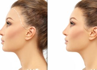 TOP 3 mocne kuracje w ampułkach na wypadanie włosów. Efekty? Wysyp baby hair i cudne zagęszczenie