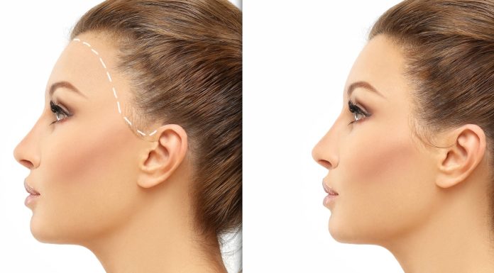 TOP 3 mocne kuracje w ampułkach na wypadanie włosów. Efekty? Wysyp baby hair i cudne zagęszczenie