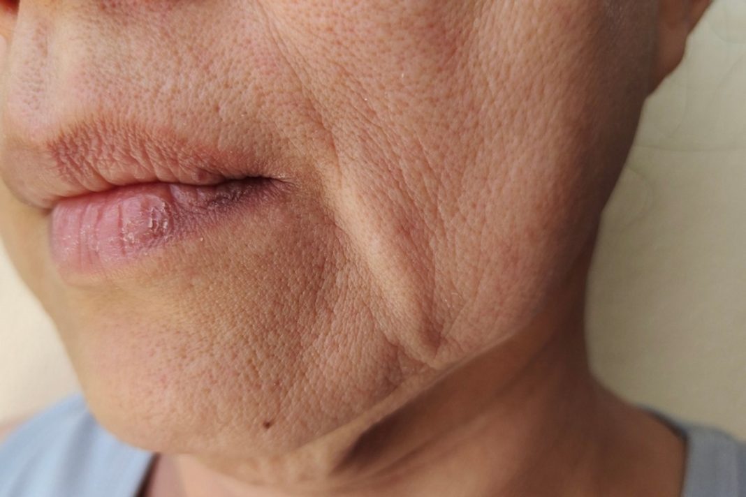 Ten krem mistrzowsko unosi opadające policzki.