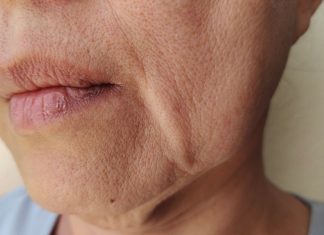 Ten krem mistrzowsko unosi opadające policzki. „Już nie myślę o liftingu”