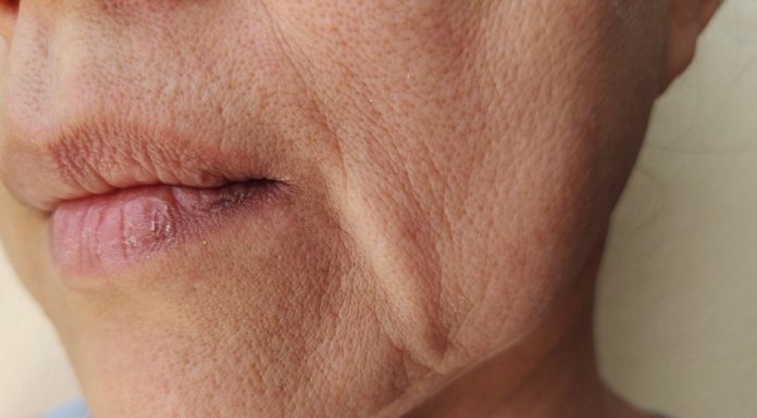 Ten krem mistrzowsko unosi opadające policzki. „Już nie myślę o liftingu”