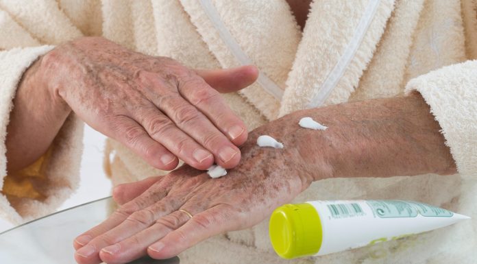 Usuwa plamki starcze z dłoni jak gumka, a kosztuje grosze