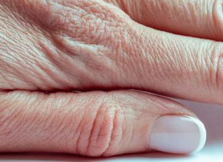 Suche dłonie to już przeszłość. Pomoże ci popularny składnik z kuchni