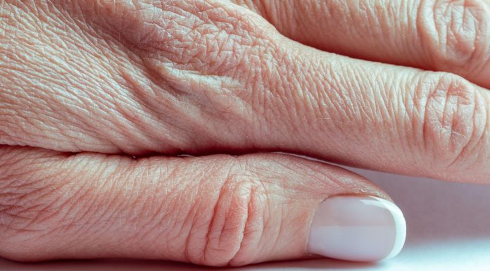 Suche dłonie to już przeszłość. Pomoże ci popularny składnik z kuchni