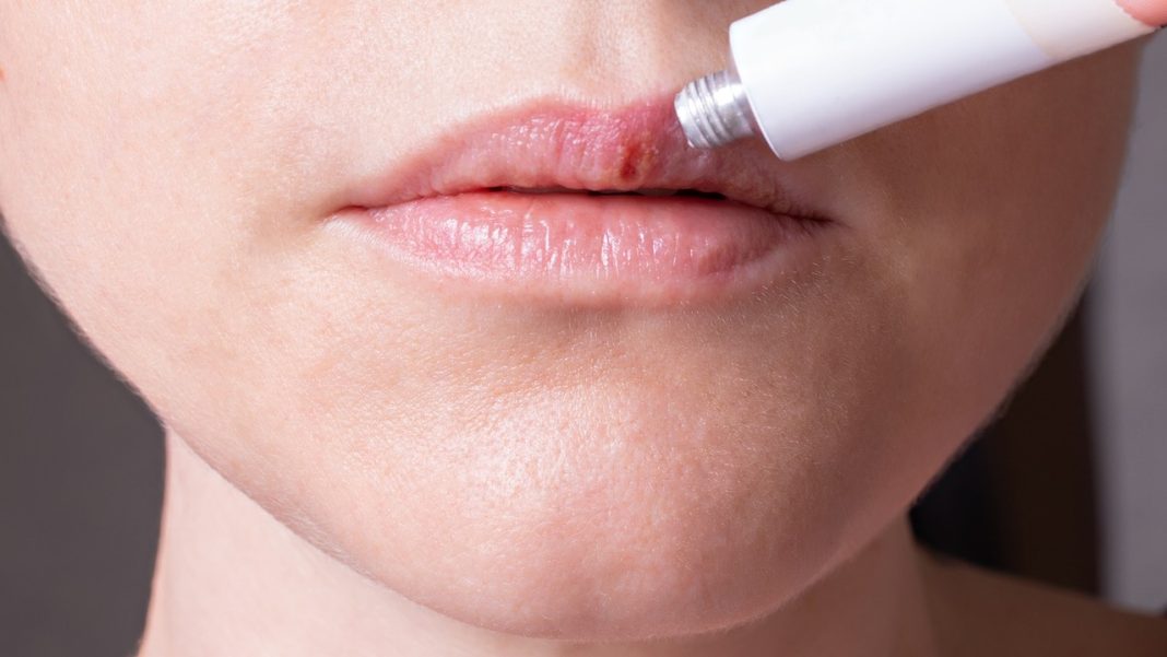 Ten cud kosmetyk kosztuje tylko 5 złotych w aptece, a jest zbawieniem na spierzchnięte usta