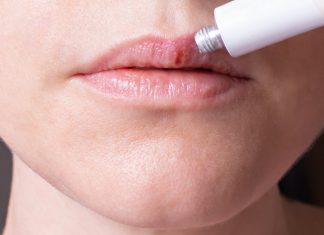 Ten cud kosmetyk kosztuje tylko 5 złotych w aptece, a jest zbawieniem na spierzchnięte usta