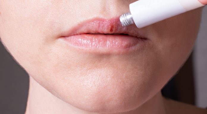 Ten cud kosmetyk kosztuje tylko 5 złotych w aptece, a jest zbawieniem na spierzchnięte usta
